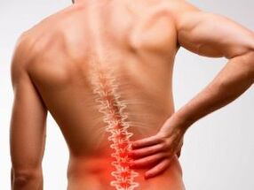 dureri de spate din cauza osteocondrozei